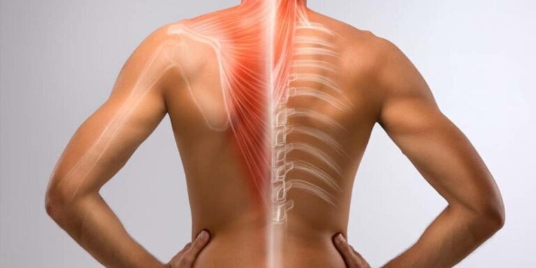 Cómo aliviar el dolor de espalda por ansiedad
