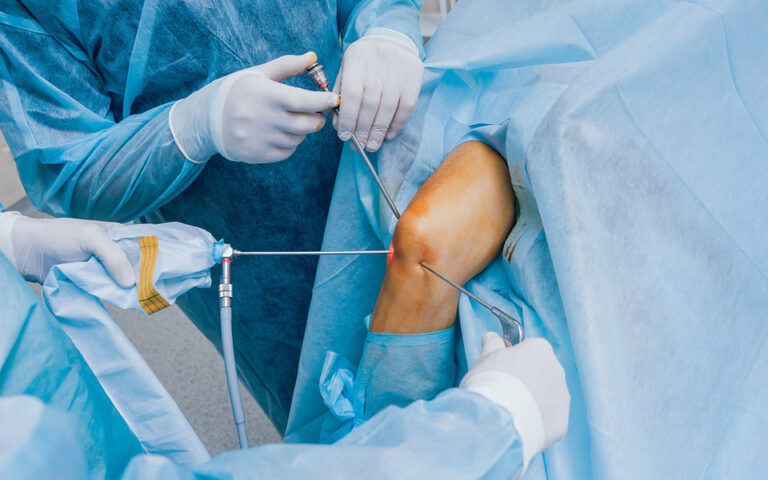 Operación de menisco externo por artroscopia