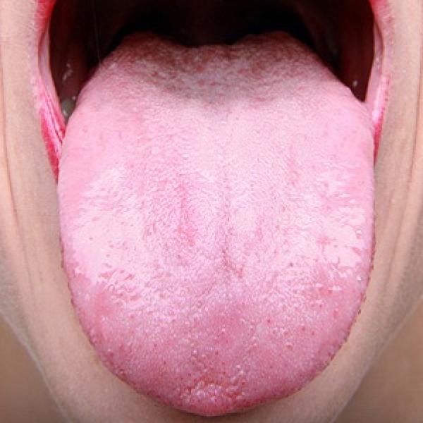 Papilas gustativas grandes al final de la lengua