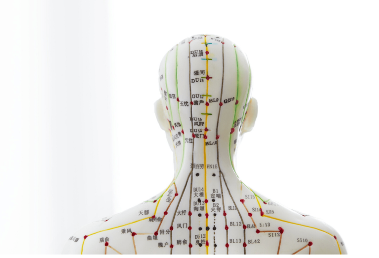 Puntos de acupuntura para dolor lumbar