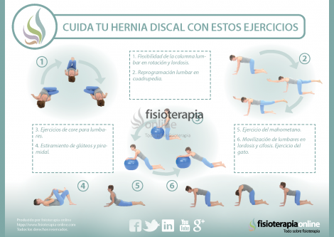 Tabla ejercicios hernia discal l5 s1