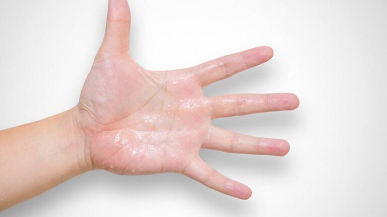 Cómo hacer que no te suden las manos